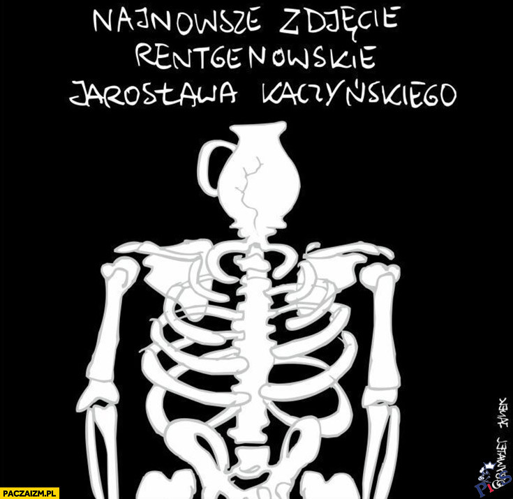 Najnowsze zdjęcie rentgenowskie Jarosława Kaczyńskiego