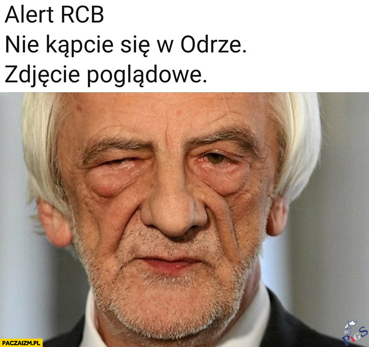 Zdjęcie poglądowe